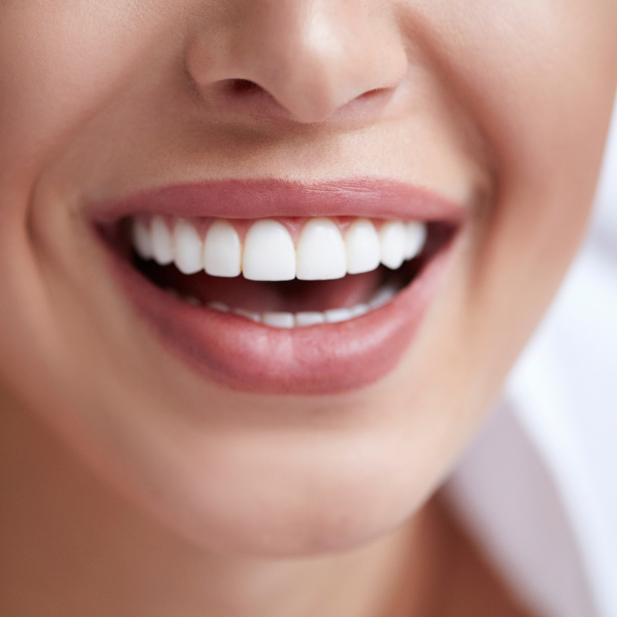 4 of the Best Natural Teeth Whitening Remedies!
